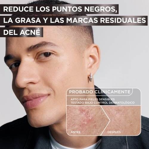 Sérum Anti Imperfecciones con Niacinamida, Ácido salicílico y Carbón